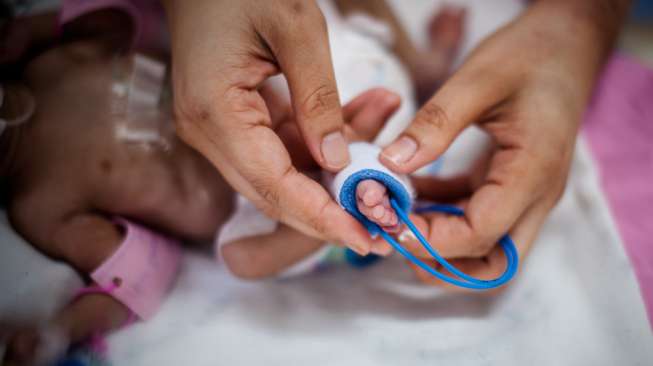 Ilustrasi bayi prematur. (Shutterstock)