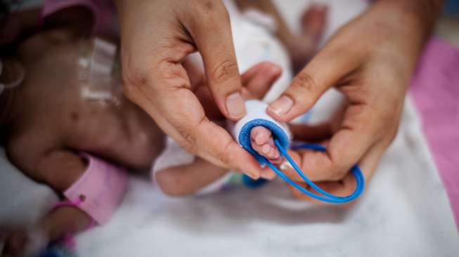 Bayi Prematur Terkecil di Dunia Berhasil Selamat, Sudah Bisa Pulang ke Rumah di Malaysia!