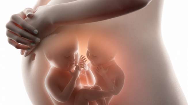 Bayi Kembar Empat Lahir di RSUP Sanglah Denpasar Melalui Metode Inseminasi