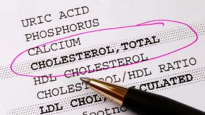 Ilustrasi hasil kadar kolesterol. (Shutterstock)