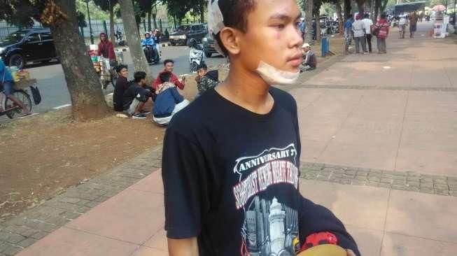 Ini Dia ABG Korban Keberingasan Remaja di Stadion GBK