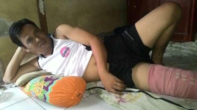 Kisah Paman Selamatkan Nyawa Keponakan dari Kobaran Api