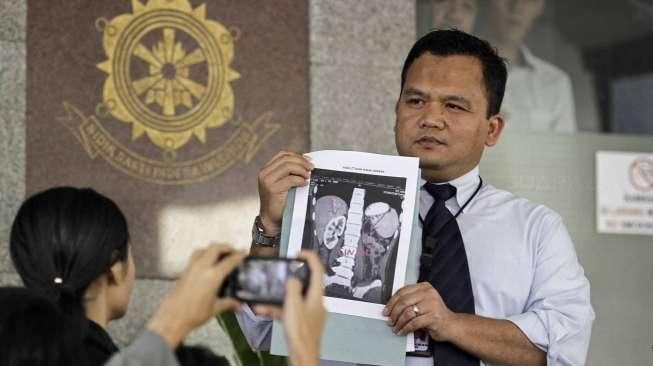 Kasubdit III Tipidum Bareskrim Mabes Polri, Kombes Umar Surya Fana, menunjukkan gambar organ tubuh manusia yang diperdagangkan, di Jakarta, Rabu (27/1/2016). [Suara.com/Kurniawan Mas'ud]