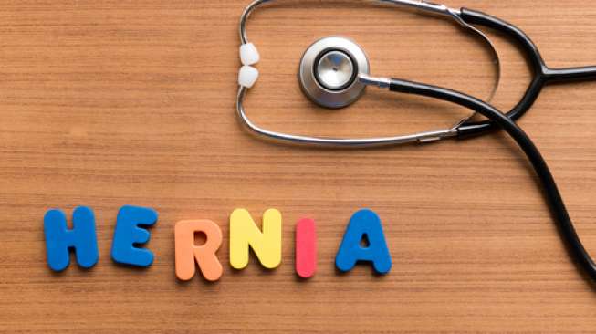 Ilustrasi hernia (shutterstock)