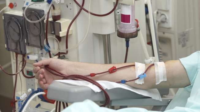 Cuci darah atau terapi hemodialisa. (Shutterstock)