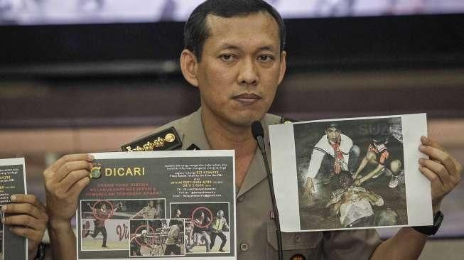 Inilah Kondisi Terakhir 5 Polisi Korban Pengeroyokan Jakmania