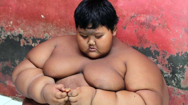 Bocah 10 Tahun Ini Miliki Bobot 192 Kg