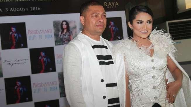 Krisdayanti Ingin Operasi Plastik di Usia 50