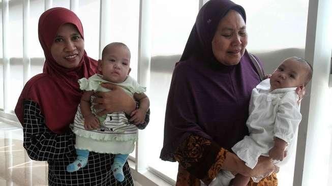 Bayi Kembar Siam Berhasil Dipisahkan