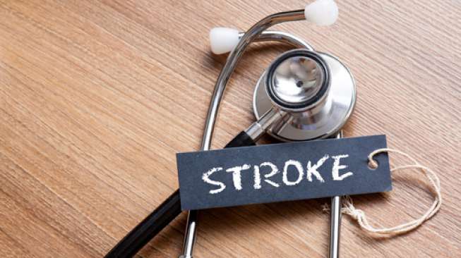 ilustrasi stroke. (Shutterstock(