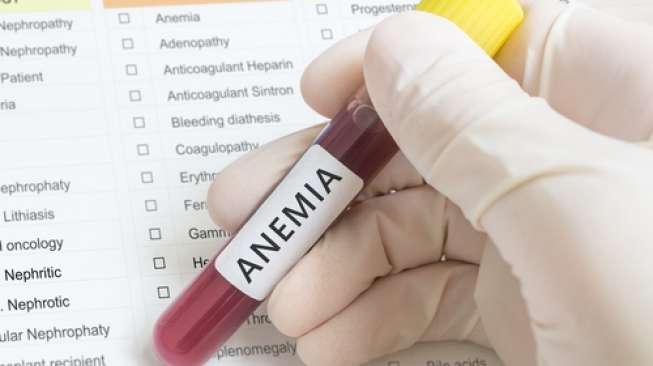 ilustrasi anemia (shutterstock)