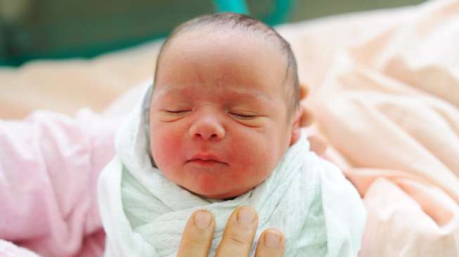 Viral Bayi 1 Bulan Keluarkan Cairan Putih Seperti ASI dari Payudara, Apa itu?