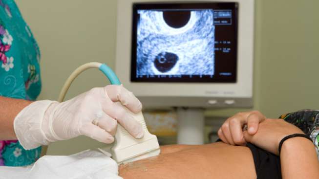 Ilustrasi pemeriksaan lambung, kehamilan, USG. (Shutterstock)