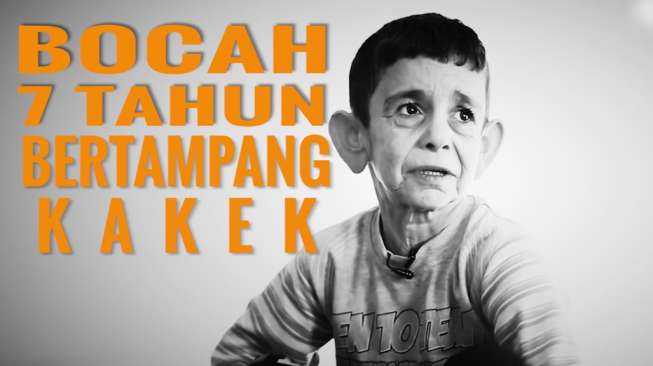 Anak Ini Baru 7 Tahun, tapi Wajahnya Seperti Kakek