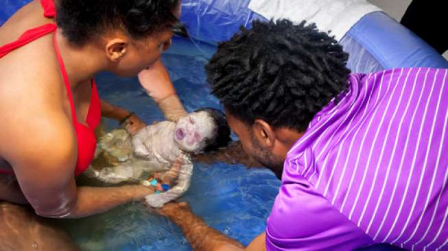 Aman, Teknik Water Birth Teruji Membuat Komplikasi Lebih Rendah