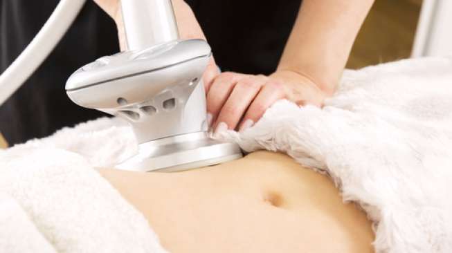Ilustrasi perempuan menjalani treatment membuang lemak di perut (Shutterstock)
