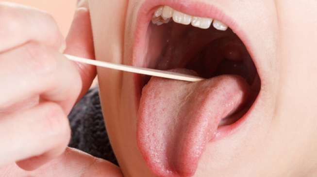 Penyakit Ini Bisa Dideteksi dari Kondisi Gigi dan Mulut Anda