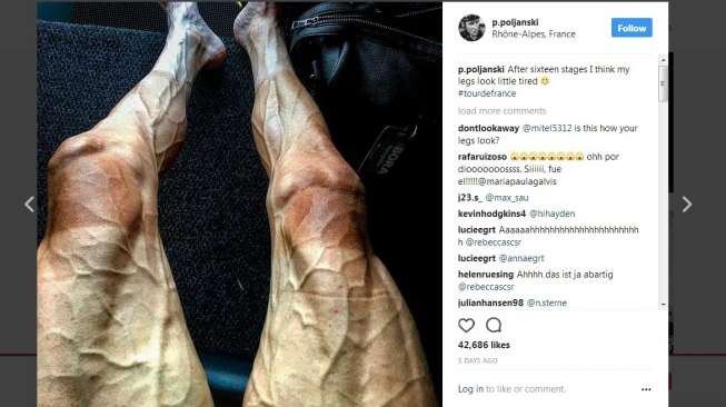 Foto Kaki "Mengerikan" Pebalap Tour de France Ini Bikin Heboh