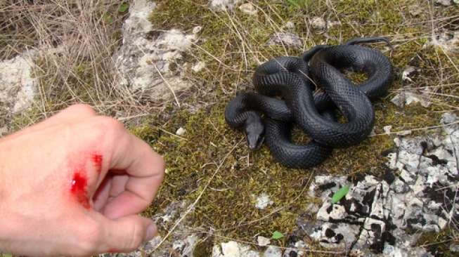 Ilustrasi tangan terluka karena gigitan ular berbisa. (Shutterstock)