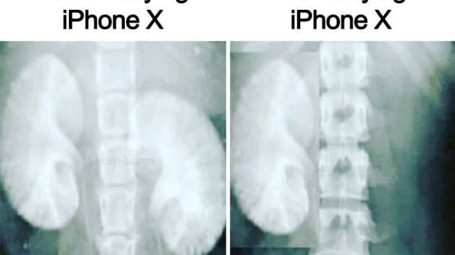 Meme Kocak, Beli iPhone X Harus Jual Ginjal