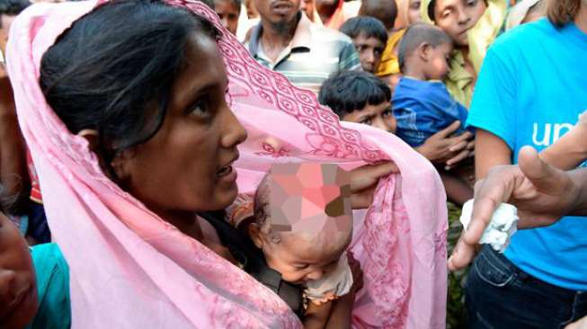 Kepala Bayi Rohingya Ini Terbakar Dilempar Granat Militer Myanmar