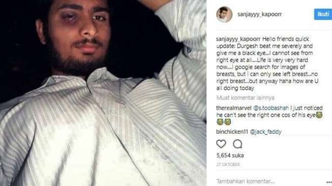 Bukan Lapor Polisi, Lelaki Ini Curhat di Instagram Usai Dihajar