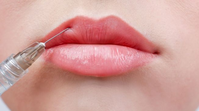 Wanita Tergiur Iklan Filler Bibir Murah di Facebook, Hasilnya Mengerikan