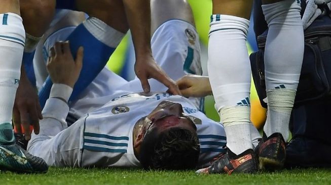 Mata Bengkak, Ronaldo Absen Bela Madrid di Piala Raja