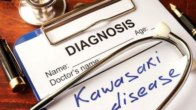 Penyakit yang diakibatkan virus Kawasaki. (Shutterstock)