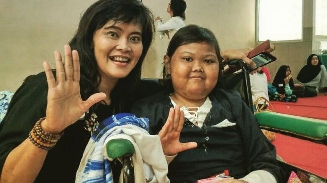 Wadah Bagi Penyandang Lupus di Indonesia. (Suara.com/Firsta Putri Nodia)