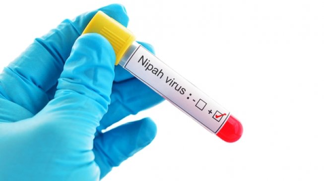 Ilustrasi virus nipah. (Shutterstock)