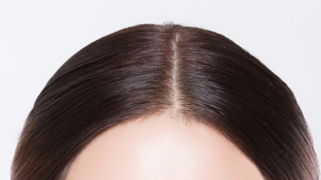 Ilustrasi kulit kepala. (Shutterstock)