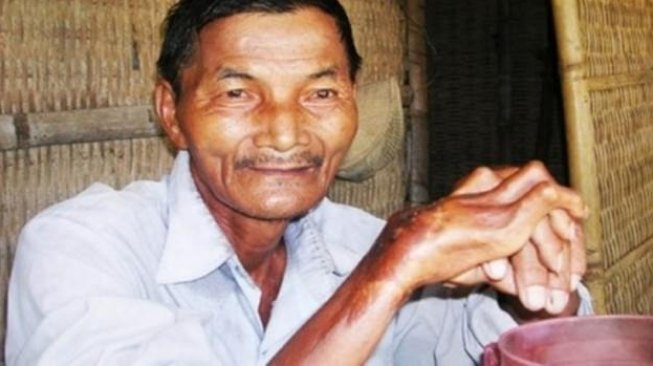 Manusia aneh dari Vietnam, selama 30 tahun Ngoc tidak tidur. (wonderslist.com) 