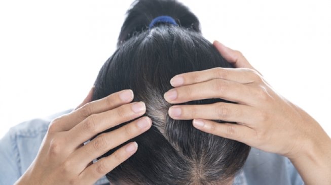 Peneliti Temukan Korelasi Antara Stres dan Rambut Beruban, Apa Itu?