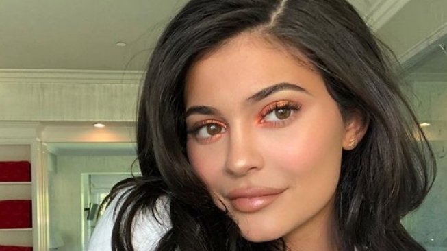 Copot Filler, Begini Penampakan Terkini Bibir Kylie Jenner