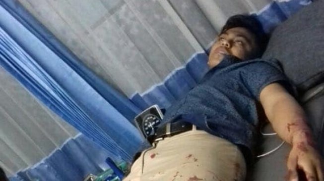 Cerita Farhan Seorang Diri Lawan 11 Begal di Atas Jembatan