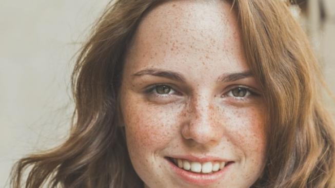 Freckles, Antara Kacamata Kesehatan dan Tren Make-up