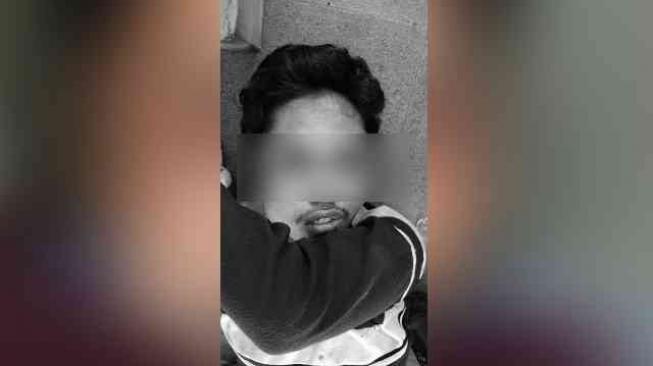 Pengakuan Remaja Terbelakang Mental: Saya Dipaksa Mengaku Maling