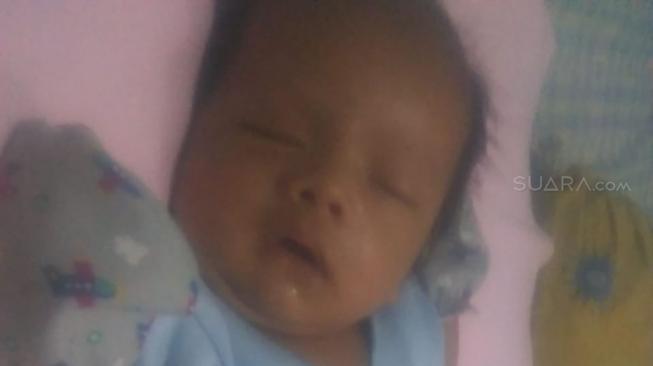 Pemkot Depok Tak Peka Terhadap Bayi yang Tak Miliki Anus