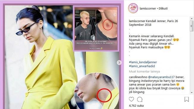 Ada tanda merah di leher Kendall Jenner, tanda cupangkah? [Instagram @lamiscorner]