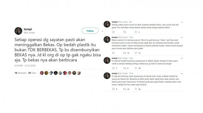 Tompi bicara soal bekas operasi plastik. [twitter/dr_tompi]