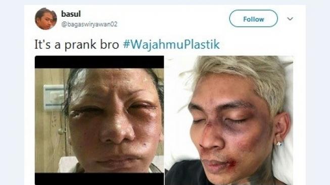 Postingan warganet soal Ratna Sarumpaet. [Twitter]