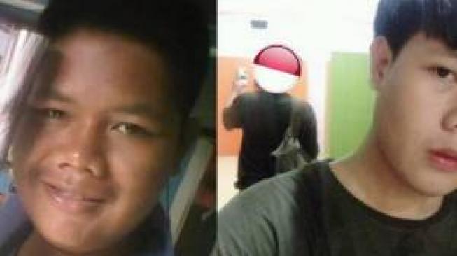 Dibully Terus Karena  Jelek, Cowok ini Putuskan Ikut Perawatan