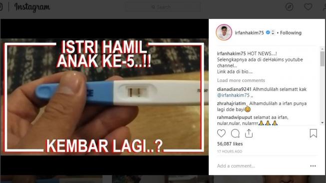 Irfan Hakim mengumumkan kehamilan istrinya. [instagram/rfanhakim75]