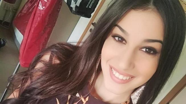 Kisah Inspiratif Chiara Bordi, Miss Italy Pemilik Kaki Prostetik