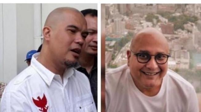 Ahmad Dhani dan Irwan Mussry Plontos, Inikah Tanda Pria Maskulin?