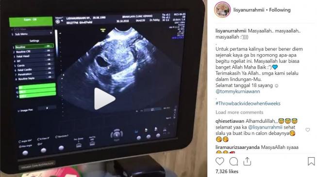 Istri Tommy Kurniawan hamil anak pertama. [instagram]