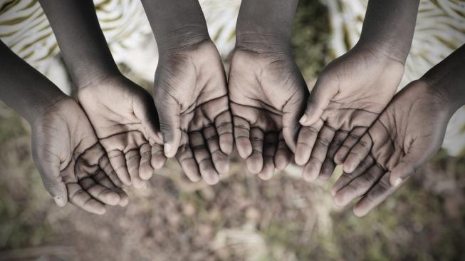 ilustrasi anak-anak malnutrisi dan gizi buruk karena kelaparan. (Shutterstock)
