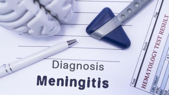 Selain Ruam, Ini 3 Gejala Meningitis yang Muncul Lebih Awal