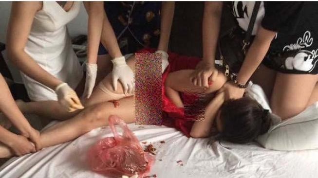 Terpergok Ngamar, Istri Siram Kemaluan Wanita Selingkuhan Suami Pakai Cabai